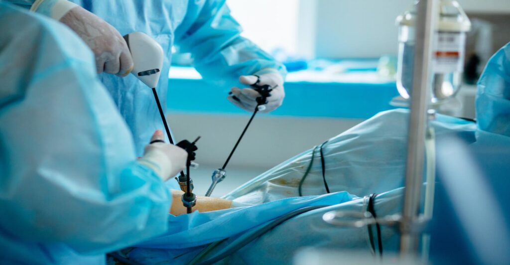 What is Complex GI Laparoscopy Surgery and Who Needs It?