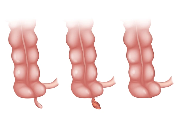 Appendix