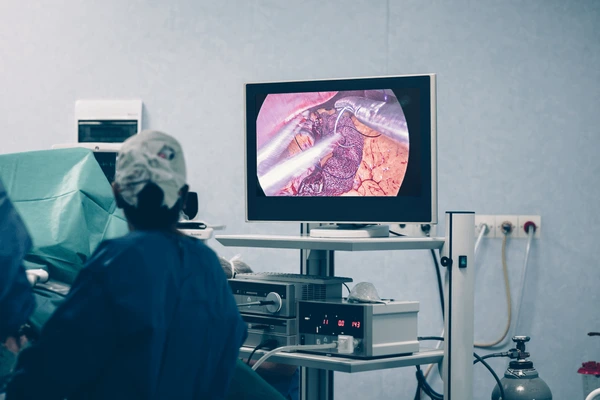 Bariatric Surgery 2