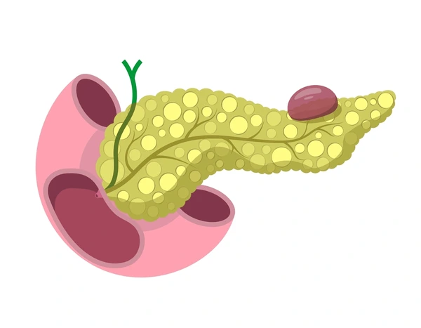 Pancreatic Cyst