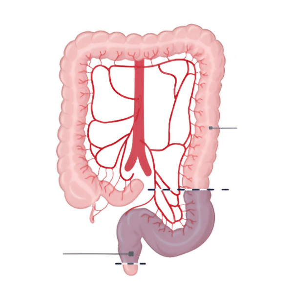 Anterior Resection
