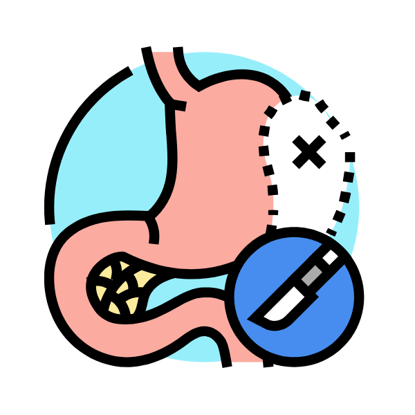 Laparoscopic Splenectomy