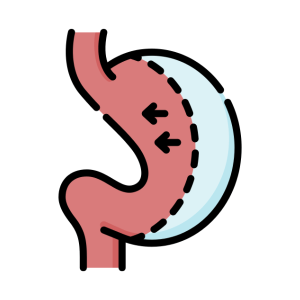bariatric surgery